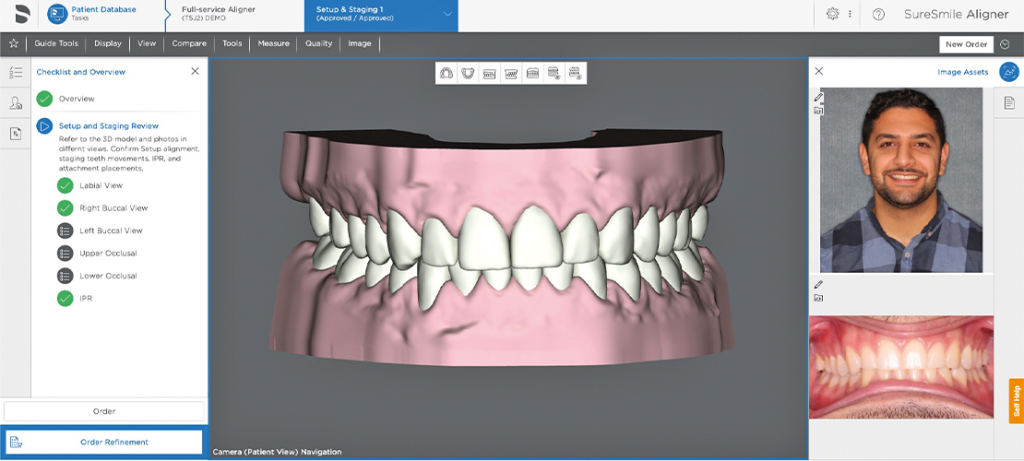 ortho extract software ortho extract software